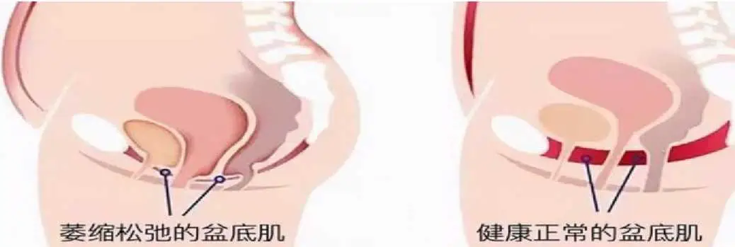 云健康亚健康_健康亚健康_啥叫亚健康